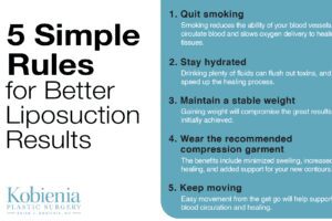 5 Simple Rules for Better Liposuction Results thumb