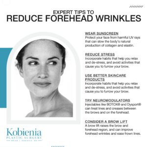 Expert Tips to Reduce Forehead Wrinkles