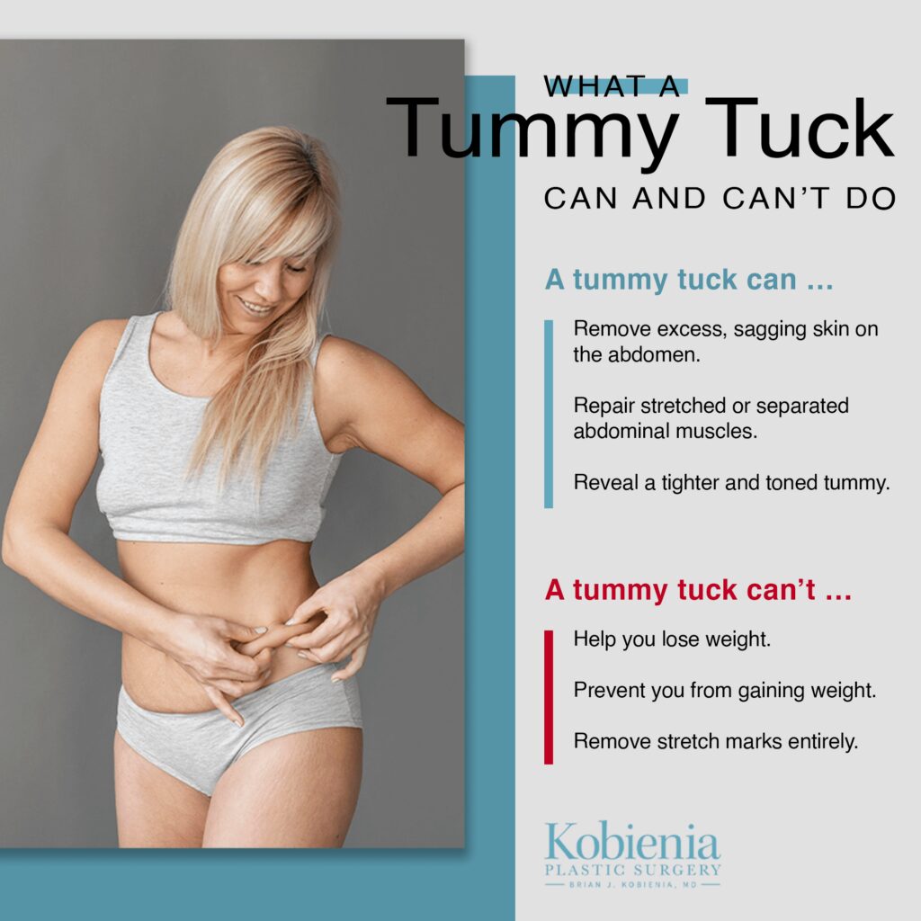 WHAT A Tummy Tuck CAN AND CAN'T DO