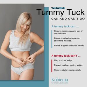 What a tummy tuck can do